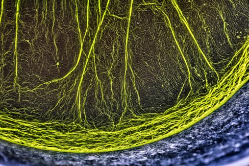une bactérie, des cellules se développent en filaments. étonnante photo by Olao. Un peu de poésie dans une monde un peu fou.